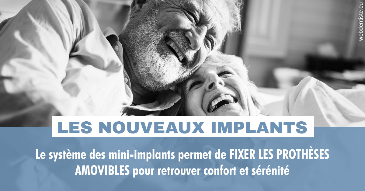 https://www.latelier-dentaire.fr/Les nouveaux implants 2
