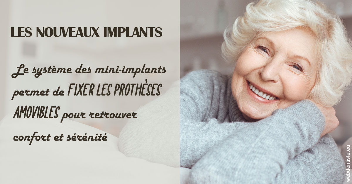 https://www.latelier-dentaire.fr/Les nouveaux implants 1