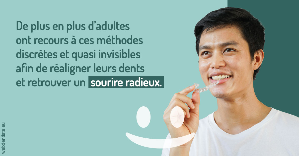 https://www.latelier-dentaire.fr/Gouttières sourire radieux 2
