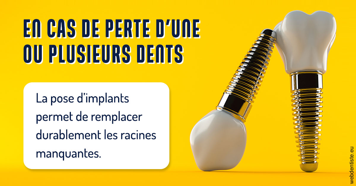 https://www.latelier-dentaire.fr/2024 T1 - Implants 02