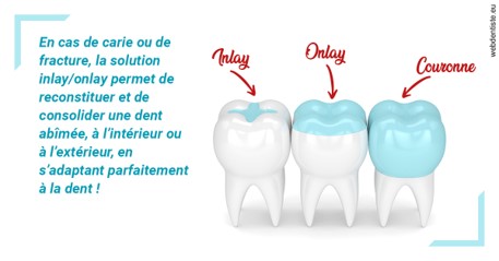https://www.latelier-dentaire.fr/L'INLAY ou l'ONLAY