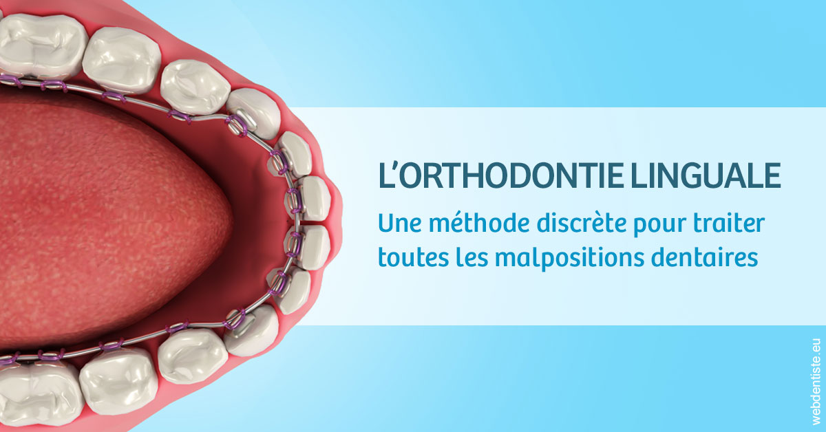 https://www.latelier-dentaire.fr/L'orthodontie linguale 1