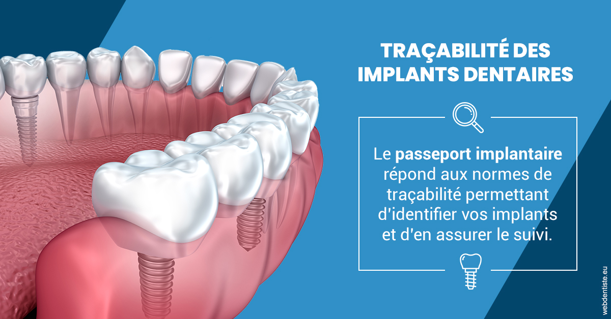 https://www.latelier-dentaire.fr/T2 2023 - Traçabilité des implants 1