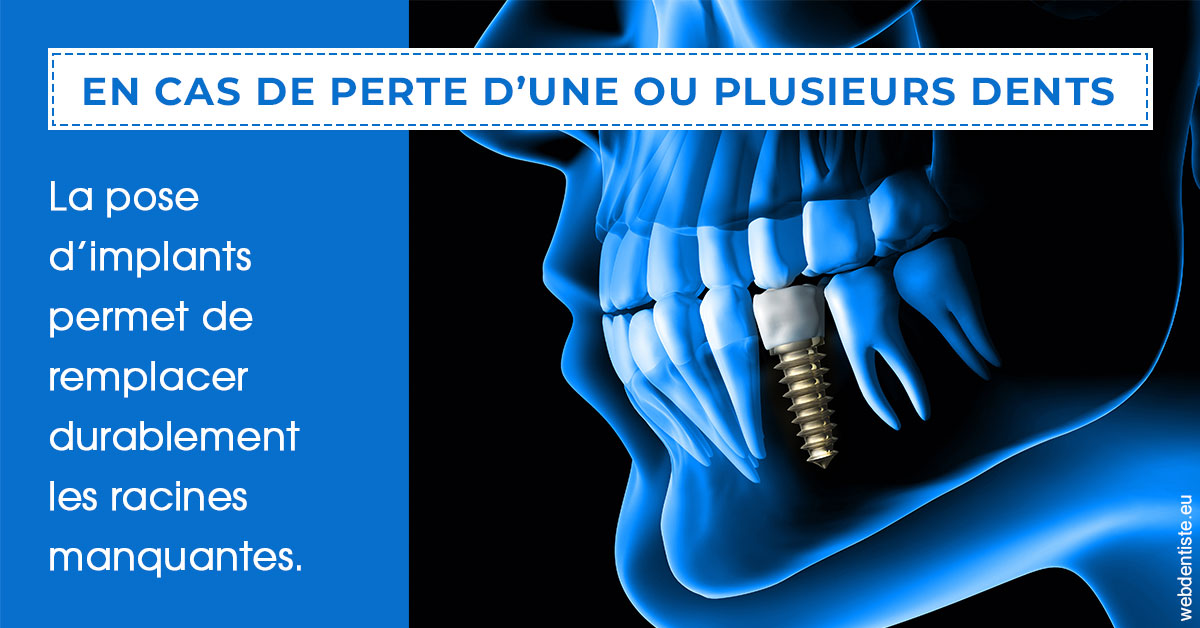 https://www.latelier-dentaire.fr/2024 T1 - Implants 01