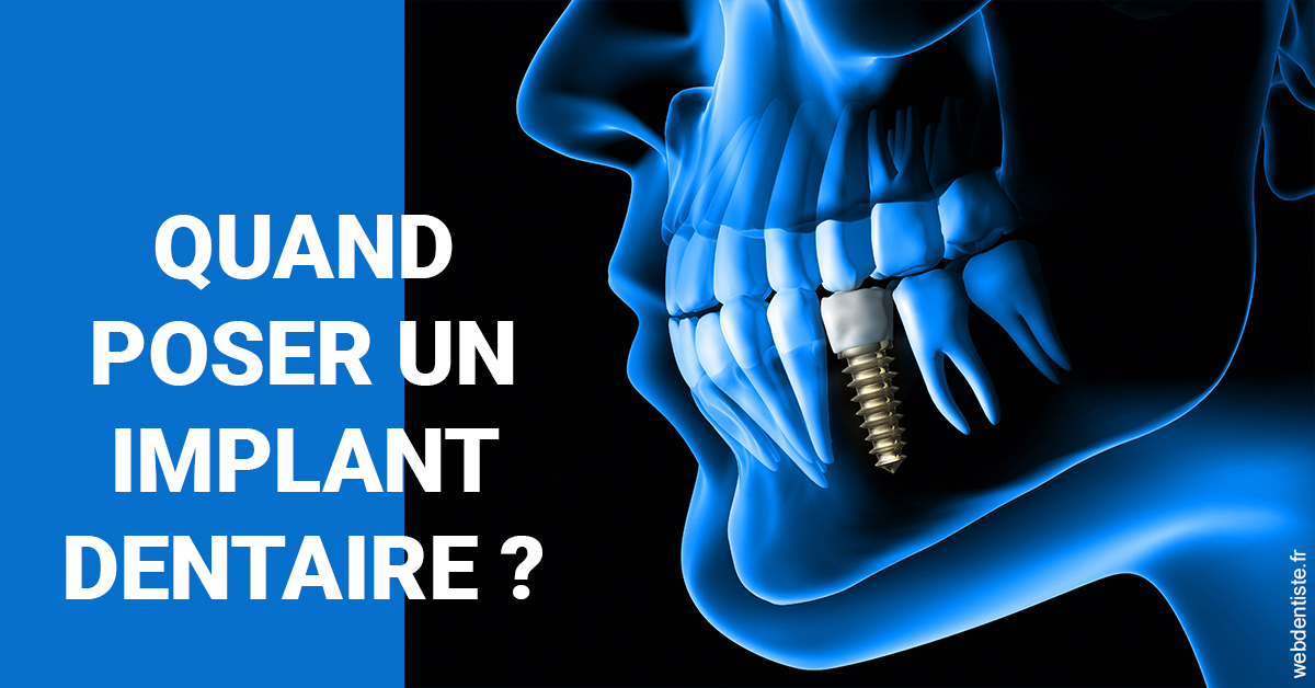 https://www.latelier-dentaire.fr/Les implants 1