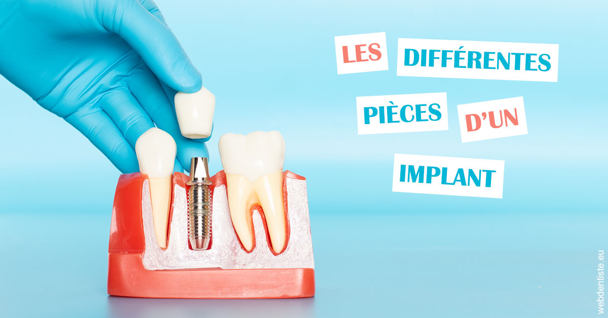 https://www.latelier-dentaire.fr/Les différentes pièces d’un implant 2