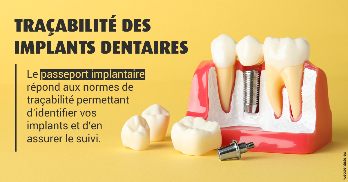 https://www.latelier-dentaire.fr/T2 2023 - Traçabilité des implants 2