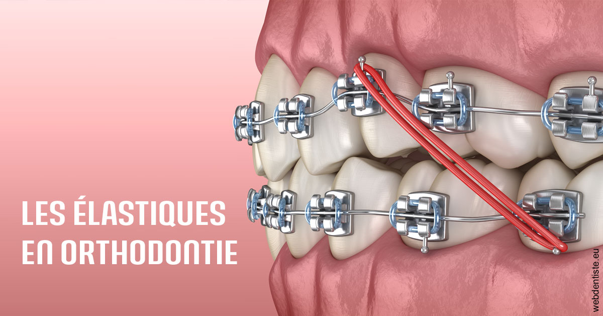 https://www.latelier-dentaire.fr/Elastiques orthodontie 2
