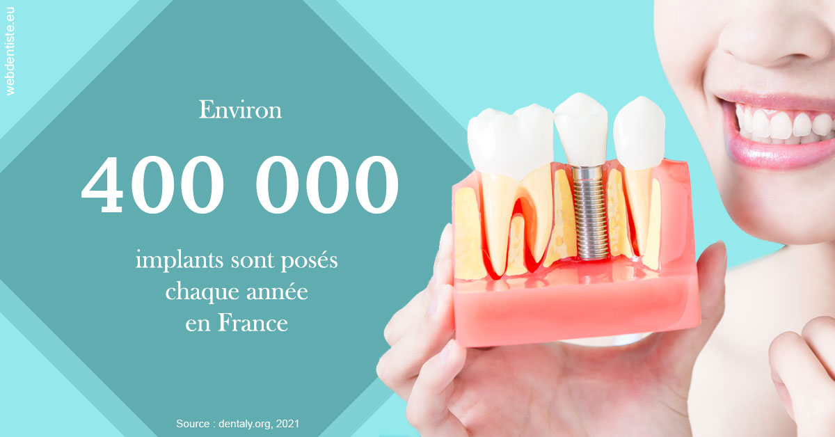 https://www.latelier-dentaire.fr/Pose d'implants en France 2