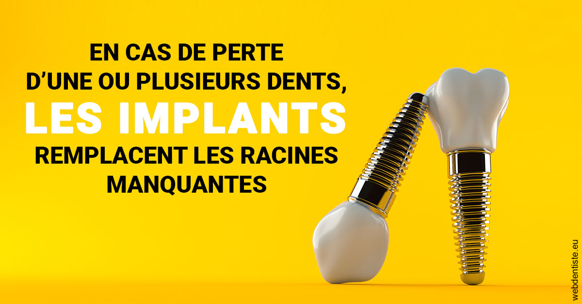 https://www.latelier-dentaire.fr/Les implants 2