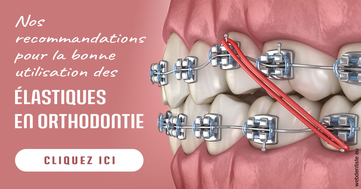https://www.latelier-dentaire.fr/Elastiques orthodontie 2
